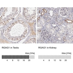 RGAG1 Antibody, Novus Biologicals 25 &mu;L; Unlabeled:Antibodies, Polyclonal